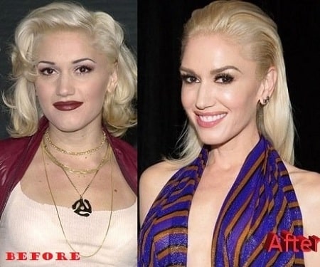 A before and after picture of Gwen Stefani.